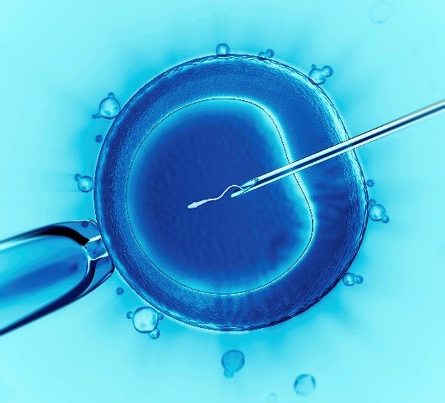 How Does IVF (In Vitro Fertilization) Work Anyway?