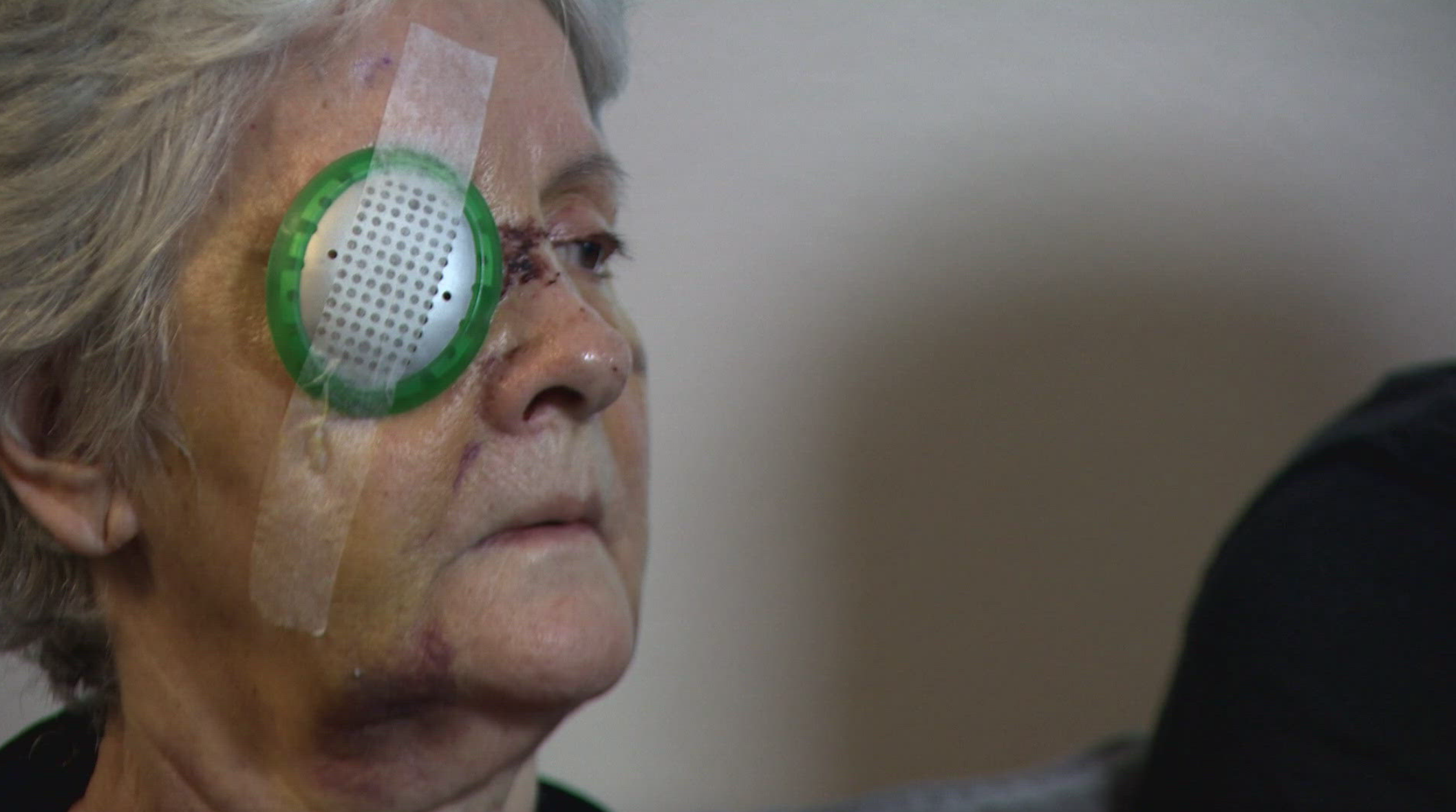 Granny’s Eye Destroyed by Bolt-Studded Board in Savage Ambush