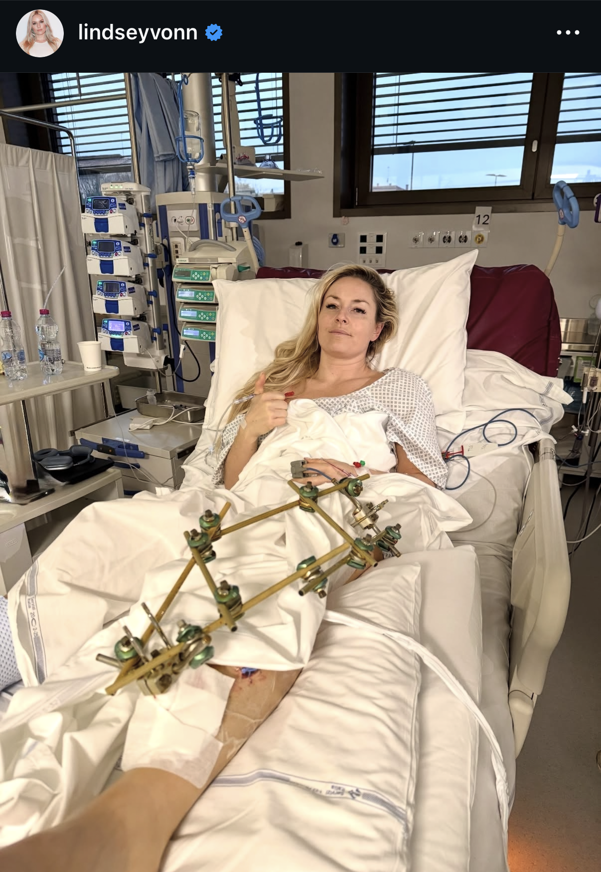 Lindsey Vonn Fires Back at Retirement Talk After Crash